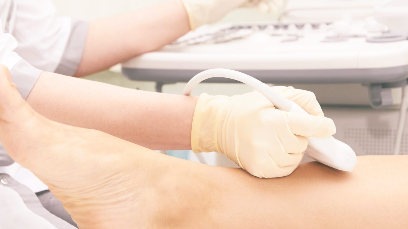 Doctor doing an ultrasound knee test