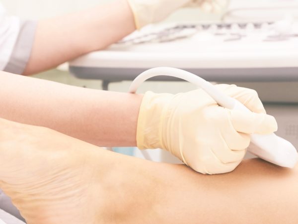 Doctor doing an ultrasound knee test