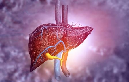Liver disease Liver with inflammatory liver disease