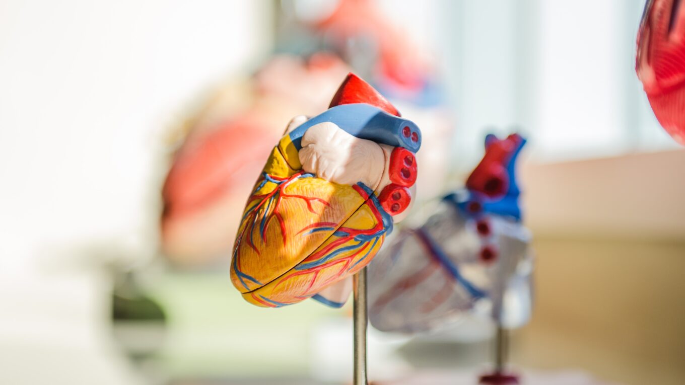 Anatomical model of a heart