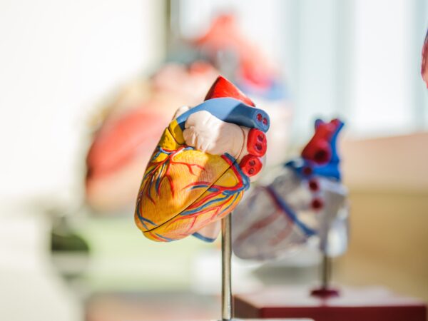 Anatomical model of a heart